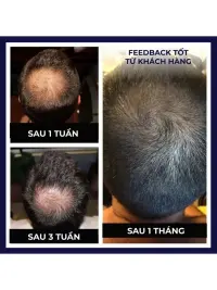 FEG Hair Strengthening Essence
